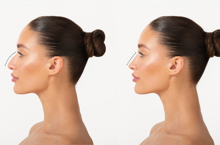 Rhinoplasty & Facial Plastic Surgery